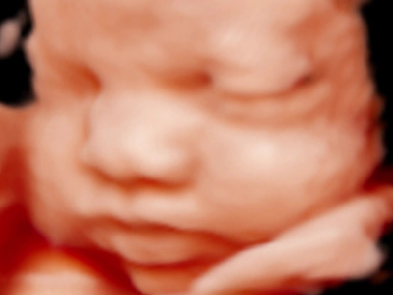 Ecografía 5D original