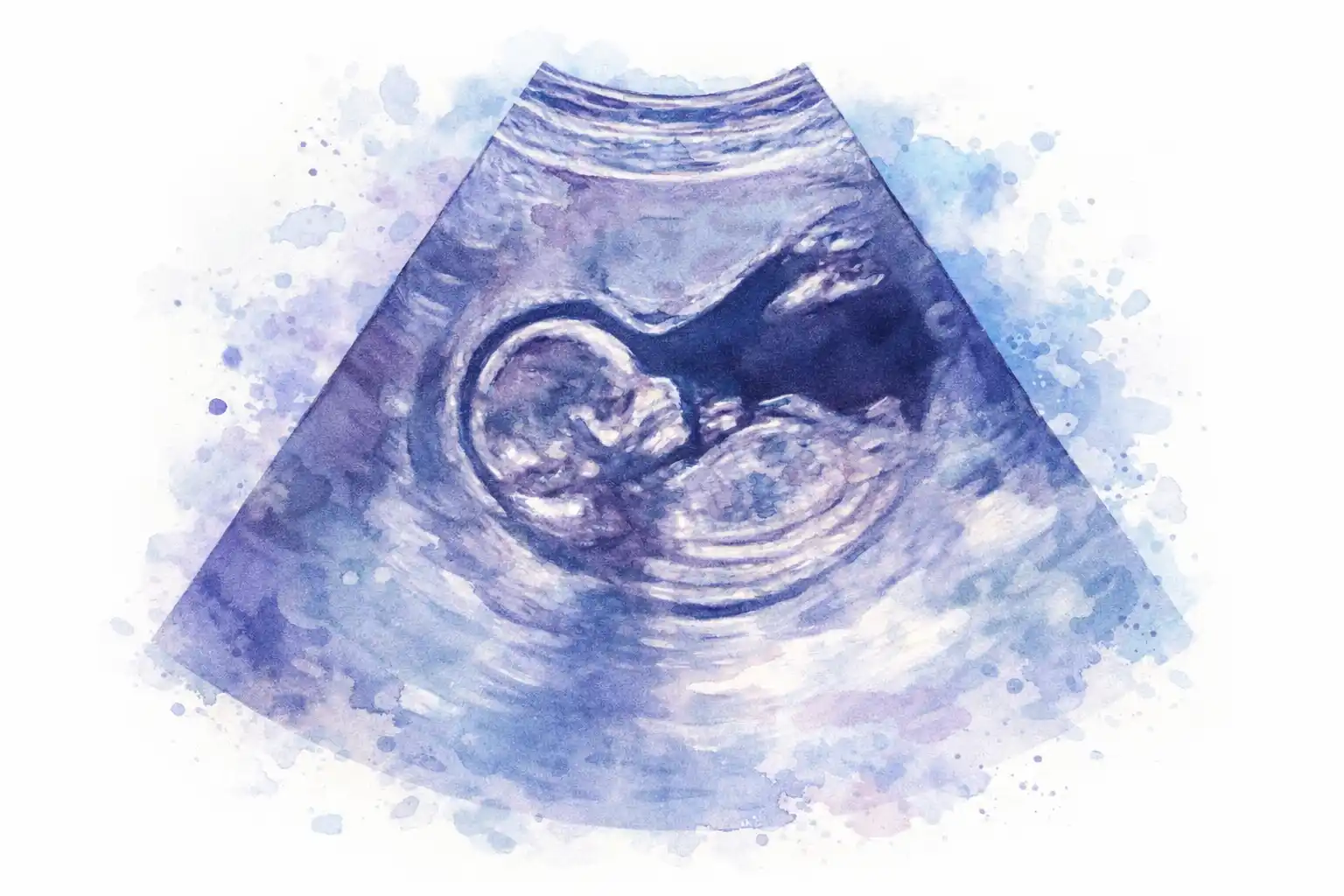 Ecografía Acuarela 1